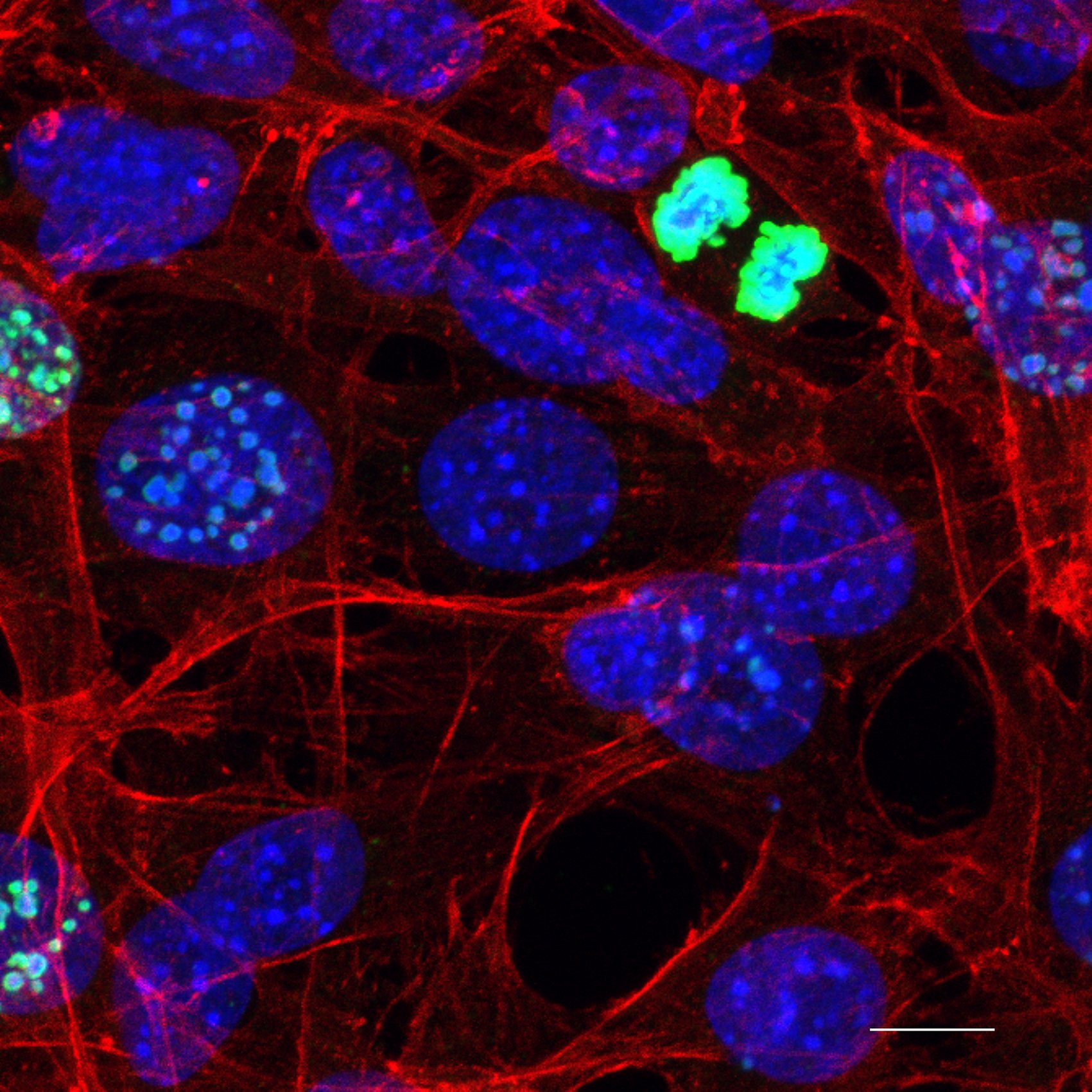La danza final de los cromosomas